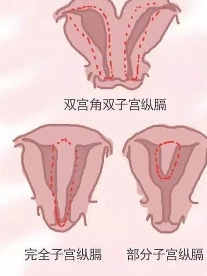 做了结扎手术可以在呼伦贝尔市试管医院做试管婴儿吗？费用是多少
